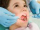 La salute orale dei bambini